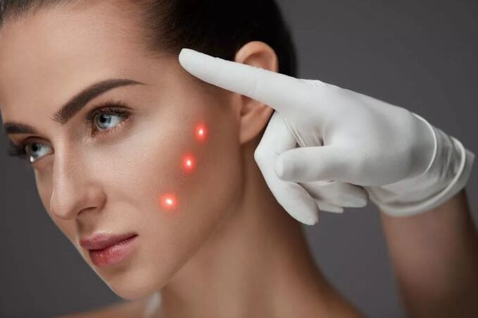 Peremajaan laser kulit