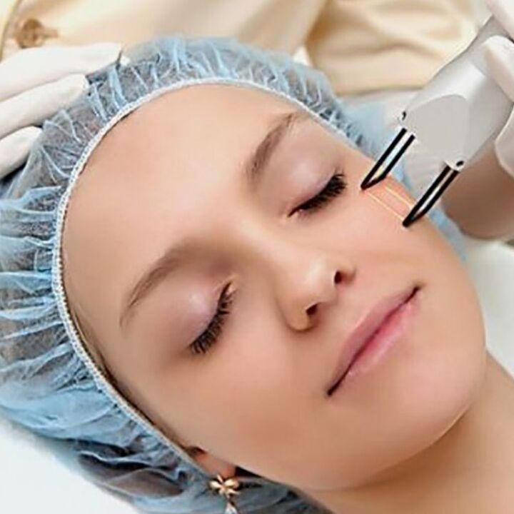 Peremajaan fraksional laser